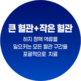 큰혈관+작은혈관 : 하지 정맥 역류를 일으키는 모든 혈관 구간을 포괄적으로 치료
